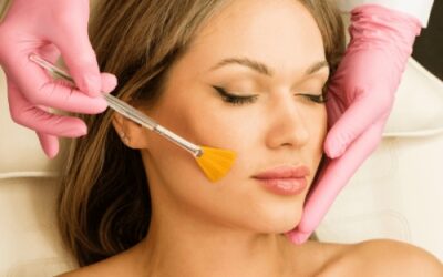 Chemical Peels for Skin Rejuvenation: Types, Benefits, and Expert Guidance