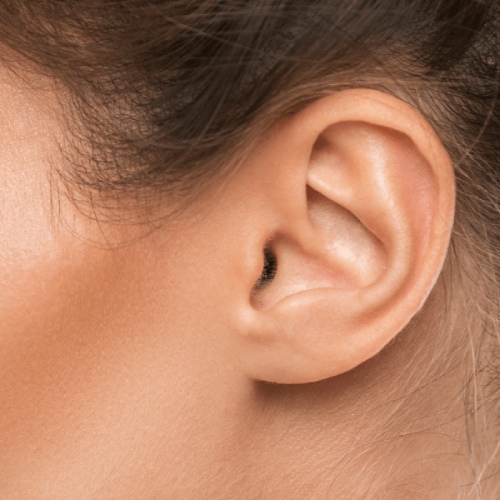 Earlobe Dermal Fillers