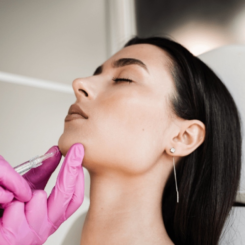 Jawline Dermal Fillers