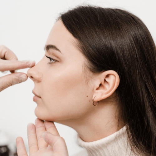 Nose Job Dermal Fillers